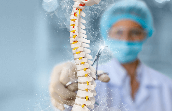 Cirugía de columna